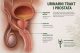 Povezanost prostate i urinarnog sistema kod muškaraca